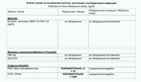 Справка об отсутствии ВИЧ-инфекции и сифилиса 